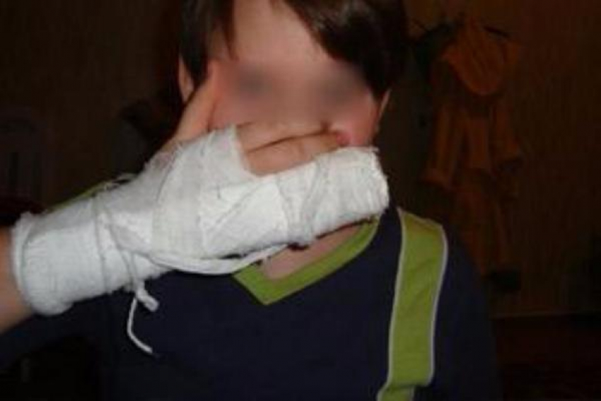 На севере Волгограда 11-летний мальчик сломал руку гимназисту во время игры