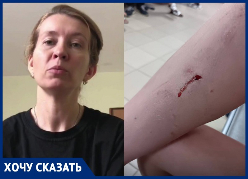 Мамы просят усмирить злобную овчарку, напавшую на двоих детей в Волгограде