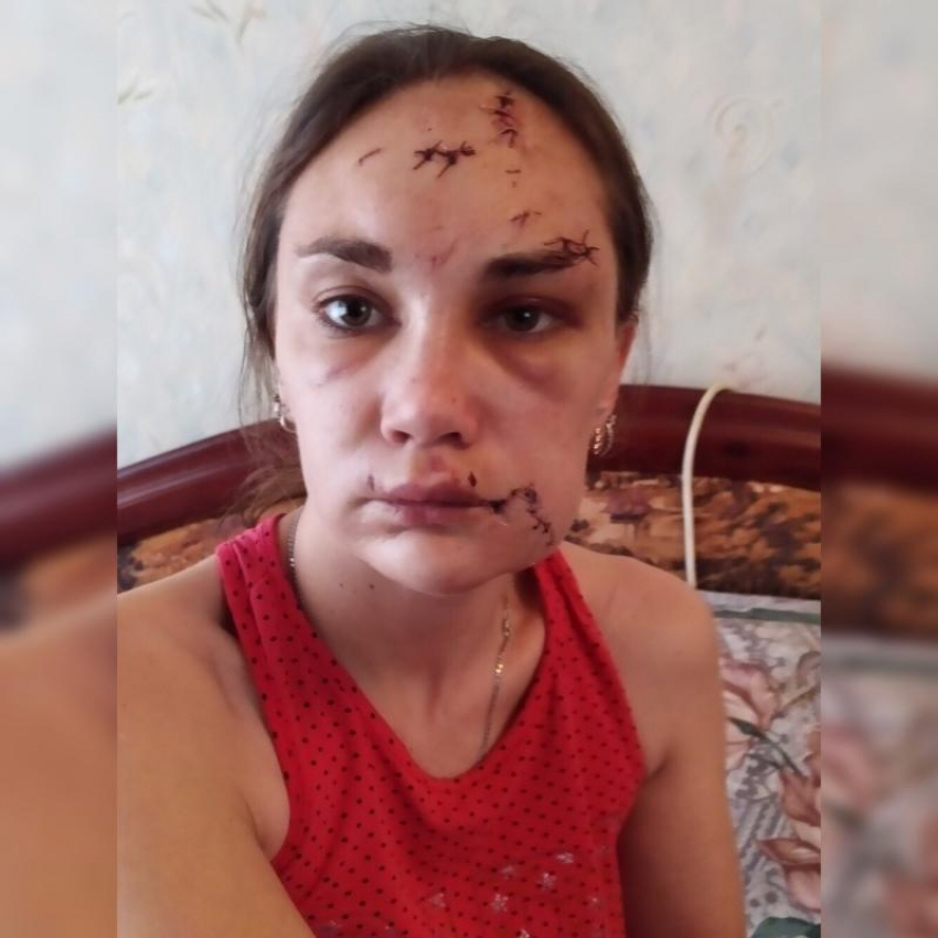 Прохор Шаляпин поддержал жительницу Урюпинска, которой экс-супруг порезал лицо