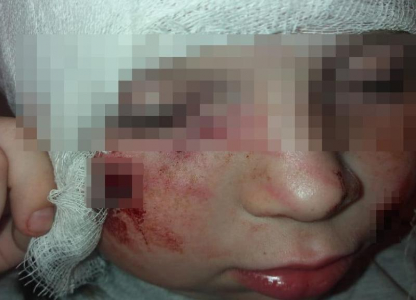 Бродячая собака разорвала лицо 7-летней девочке в Волгоградской области