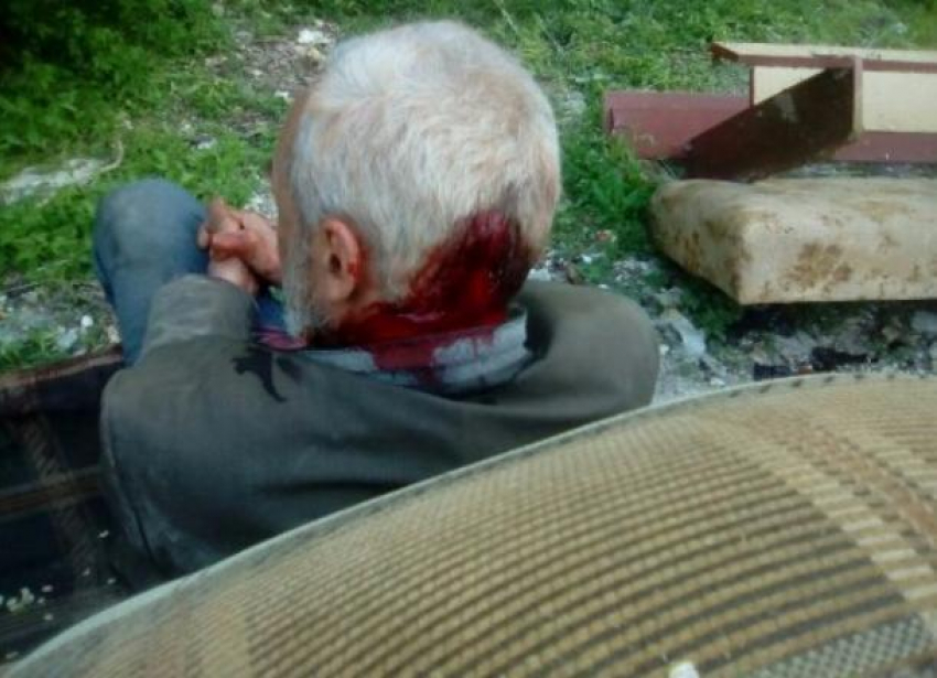 В Волгограде школьник шутки ради пробил камнем голову пенсионеру