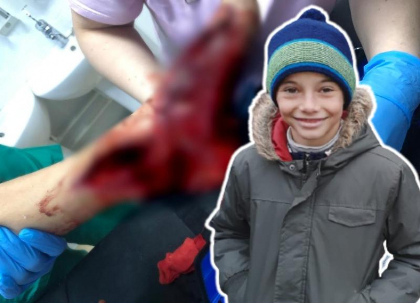 Мотороллер разрубил 12-летнему ребенку ногу в Волгоградской области:  родители требуют наказания для виновных