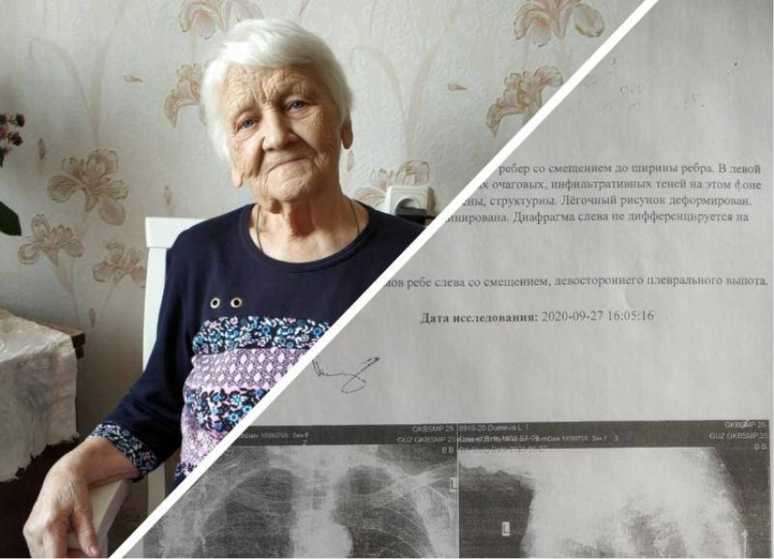 «Состояние улучшилось»: 82-летнюю пенсионерку с 5 сломанными ребрами госпитализировали после публикации «Блокнот Волгоград»