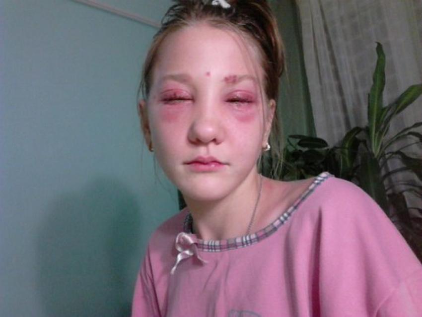 Волгоградскую парикмахерскую оштрафовали на 30 тысяч за сожженные глаза 13-летней девочки