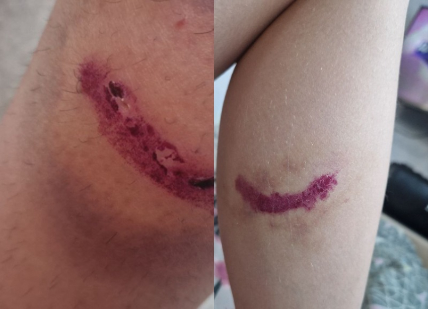 Собаки напали на 9-летнюю школьницу в Волгограде