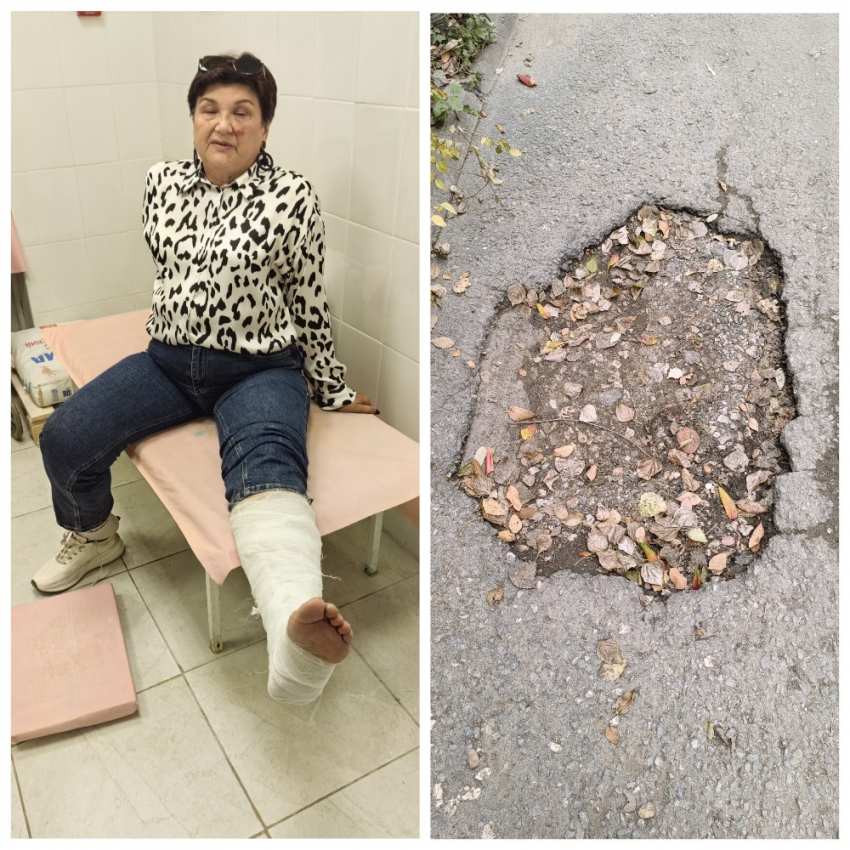 Сломала ногу и разбила лицо волгоградка на жуткой дороге