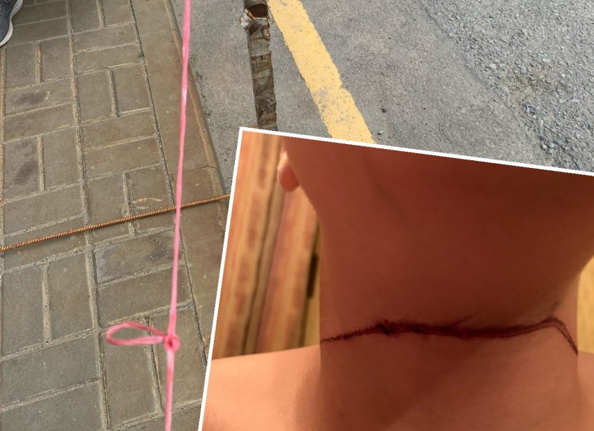 12-летний мальчик получил жуткие травмы на шее из-за натянутой веревки во дворе дома в Волгограде